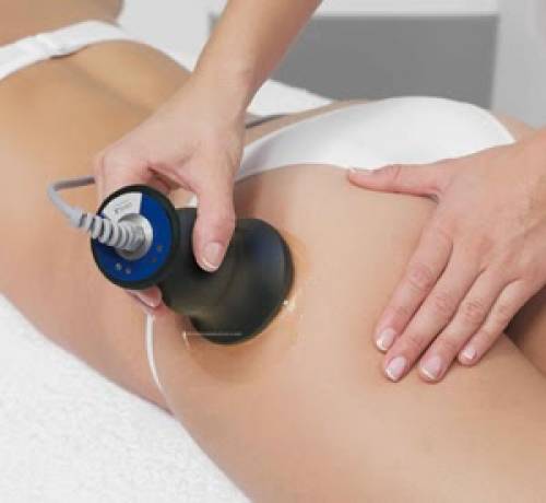 Foto Centro de est�tica Avanzada Platinum